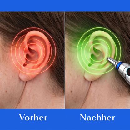 Tinnacur™ | Ohrgeräusche in Sekunden stoppen